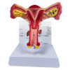 Sistema reproductor femenino modelo anatomico - Utero